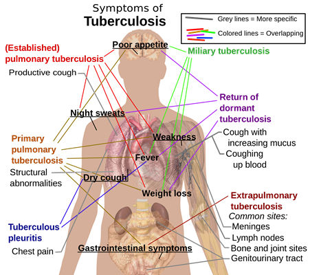 Top 10 Worst Diseases in The World