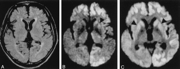 Incurable Diseases