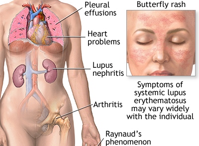 Incurable Diseases