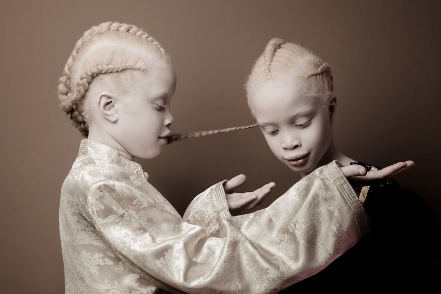 Albino Twins Models